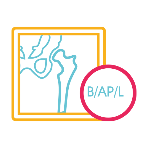 Femur Bilateral, Ap y Lateral