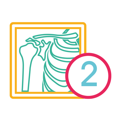 Hombro 2 Proyecciones