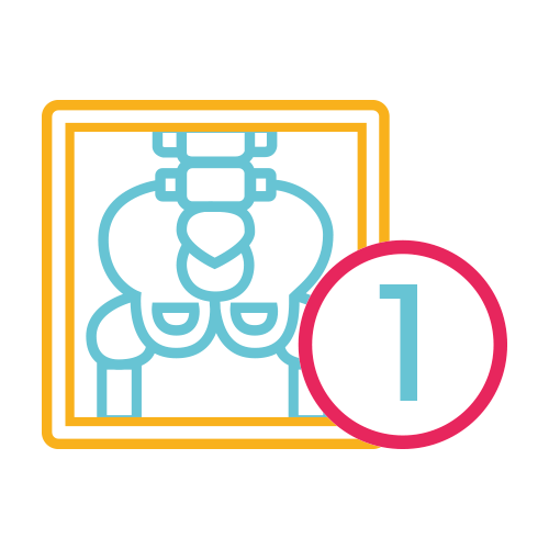 Pelvis 1 Proyección