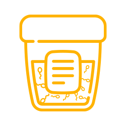 Espermatobioscopia (Seminograma)