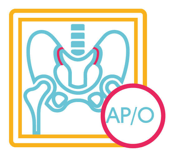 Articulación Sacro Iliacas (Ap y Obli.)